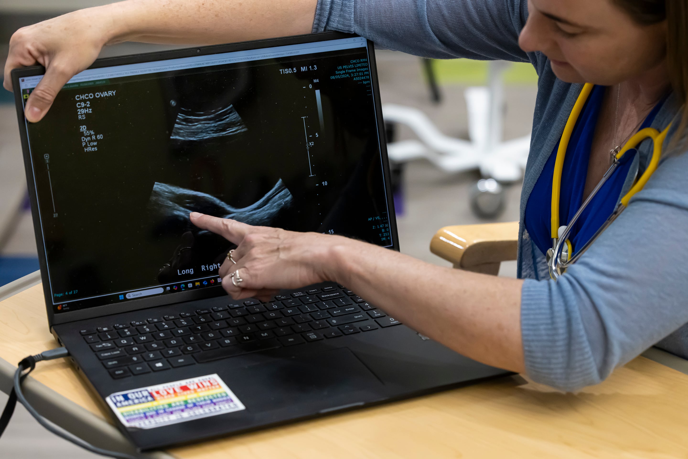 Reconocerse en un testimonio de internet ante el infradiagnóstico del síndrome de ovario poliquístico